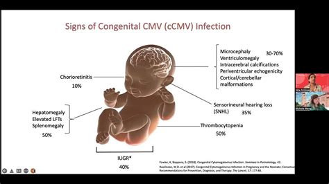 Understanding Congenital Cytomegalovirus From Diagnosis To Management