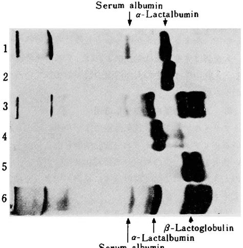 Figure From Fractionation Of Human Milk Whey Protein By Acrylamide