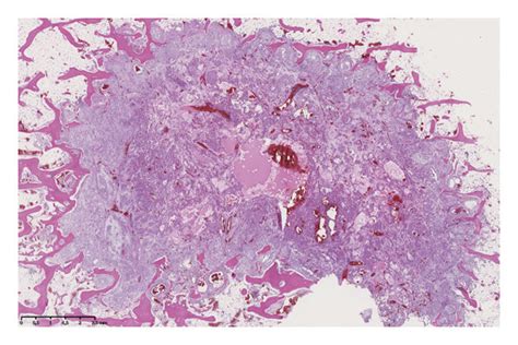 Characterization Of The Lesions On Mri Macroscopic Microscopic And