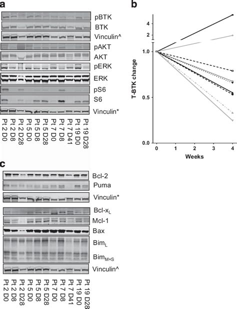 Changes In BCR Pathway Protein Levels And Signaling In CLL Cells Before