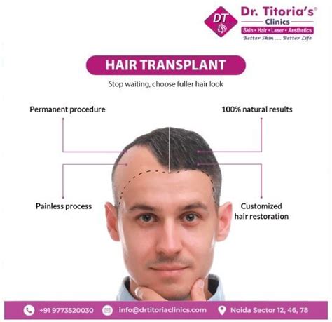 Customized Hair Transplant Solution For Fuller Hair