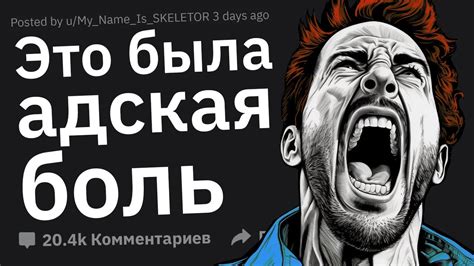 Худшая Физическая БОЛЬ в Вашей Жизни #2 - YouTube