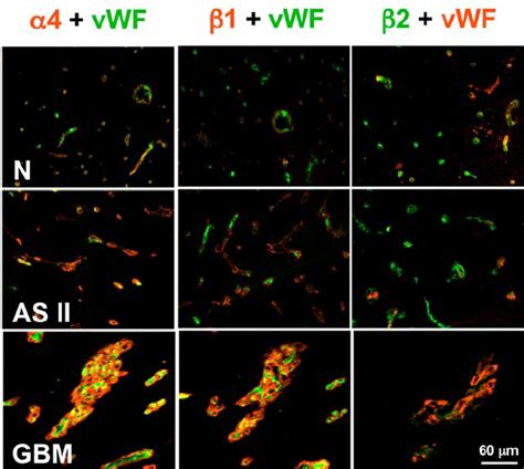 Double immunofluorescent staining of brain tissues for laminin 8 α 4