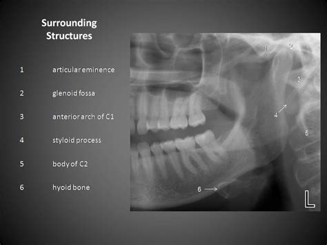 How To Read Dental Xrays