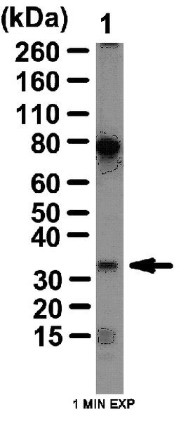 Anti Toll Interacting Protein Tollip Antibody 06 1109