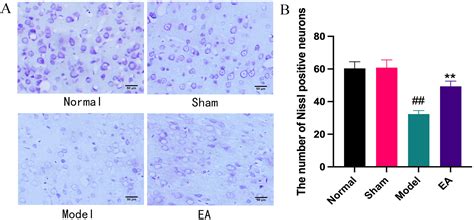 Electroacupuncture Increases The Expression Of Gas7 And NGF In The