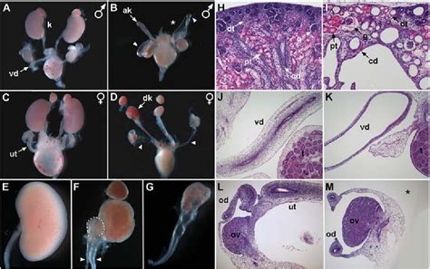 Congenital Absence Of Uterus Semantic Scholar