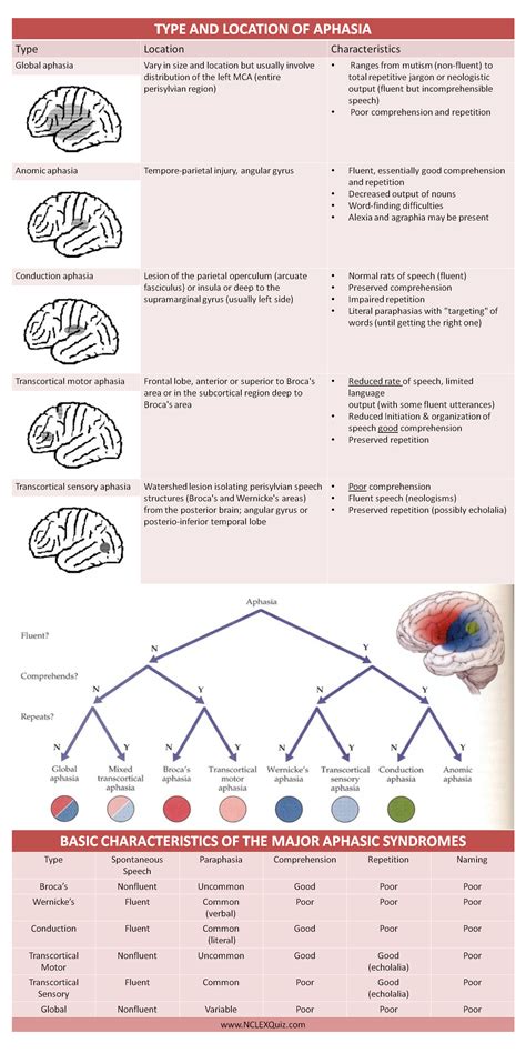 Types Of Aphasia Chart Aphasia Speech Esquema Decision Aphas