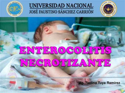 Enterocolitis Necrotizante BARRÓN MARTINEZ JENNIFER uDocz