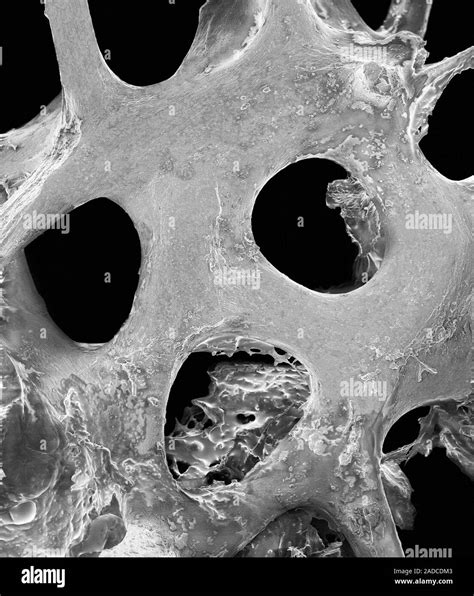 (Esponjoso) tejido óseo esponjoso, análisis micrografía de electrones (SEM). El tejido óseo se ...