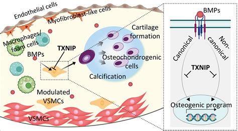 Txnip Suppresses The Osteochondrogenic Switch Of Vascular Smooth Muscle