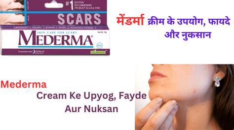 Mederma Cream Ke Upyog Fayde Aur Nuksan मडरम 10 G करम क उपयग