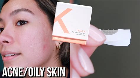 ZitSticka KILLA Patch Review The Best Zit Stickers YouTube