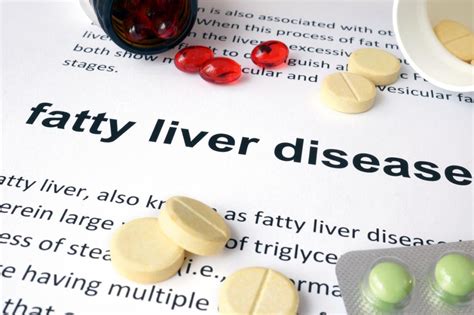 Fatty Liver Diagnosis Of Advanced Fibrosis From Stool Microbes Shows