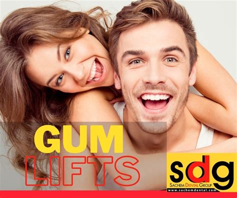 The Gum Lift Procedure Sachem Dental Group