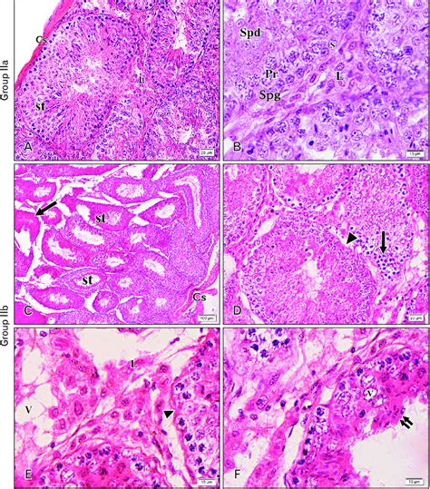 Photomicrographs Of A Sections Of The Testis From Mice From The Stained