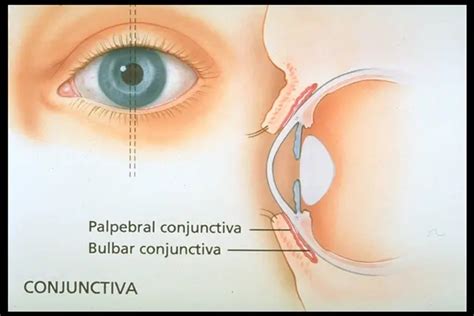 Conjunctival/scleral anatomy - American Academy of Ophthalmology