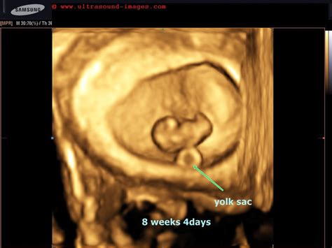 A Gallery Of High Resolution Ultrasound Color Doppler And 3d Images