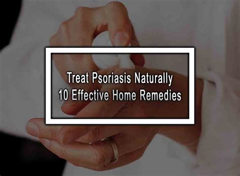 Treat Psoriasis Naturally - 10 Effective Home Remedies