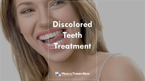 Teeth Discoloration The Causes And What You Can Do About It Medical Trends Now