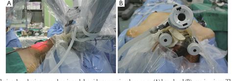 Figure From Transoral Robotic Thyroid Surgery Semantic Scholar