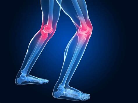 Osteoarthritis: 10 Osteoarthritis Symptoms