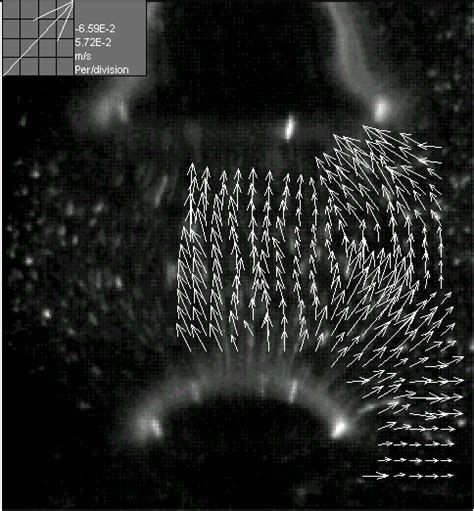 Flow Field At The Expansion Stage Of Bubble Formation At A Mm Pvc