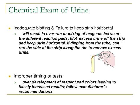 Ppt Clinical Urinalysis Review Powerpoint Presentation Id