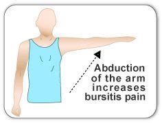 35 Bursitis Shoulder Ideas Bursitis Bursitis Shoulder Deep Tissue