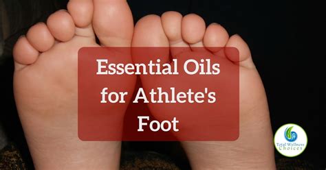 Best Essential Oils For Athletes Foot Tinea Pedis Diy Recipes