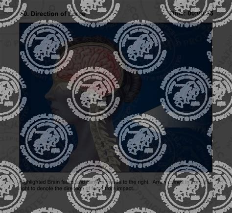 contrecoup injury storyboards