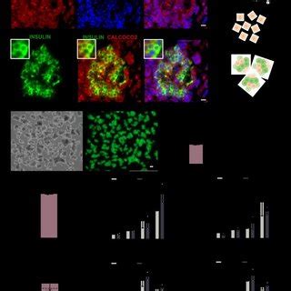 CALCOCO2 Knockdown Reduces Insulin Content In Primary Human