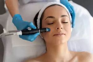 7 Cuidados Posteriores Del Dermapen Piel Bella