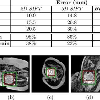 Automatic Fetal Brain Extraction From D In Utero Fetal Mri Slices