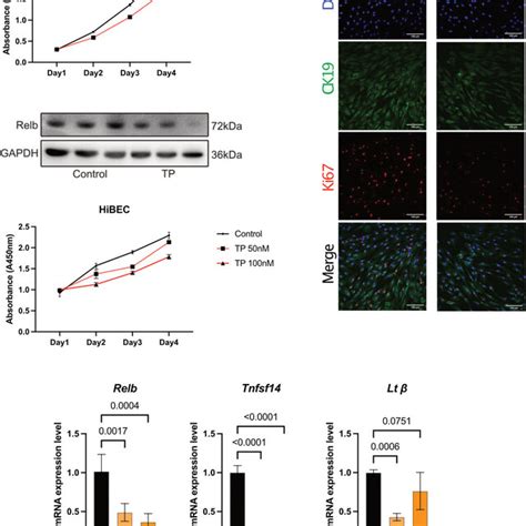 Triptolide Inhibits BDL Induced RelB And Its Downstream Gene