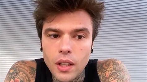 Fedez Che Malattia Ha Cos La Demielinizzazione E Cosa Pu Causare