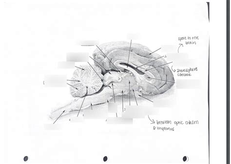 Human Brain Cut Pt 2 Diagram Quizlet