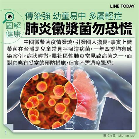 【圖解健康】肺炎黴漿菌勿恐慌 傳染強幼童易得但多輕症 Line Today Line Today