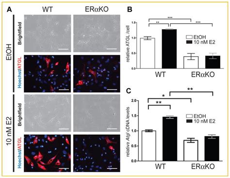 ERα regulates lipid metabolism in bone through ATGL and perilipin