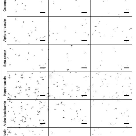 Representative Bright Field Images Of Adherent Bacterial Cells Only