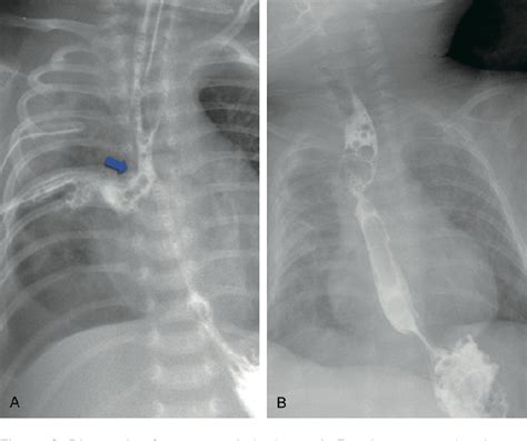 Figure 3 From Diagnosis And Management Of Post Operative Complications