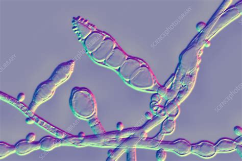 Microsporum audouinii fungus, - Stock Image - F036/7177 - Science Photo Library