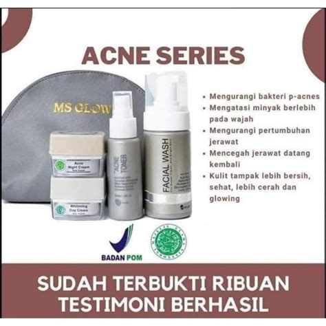 Jual MS GLOW ACNE SERIES Shopee Indonesia