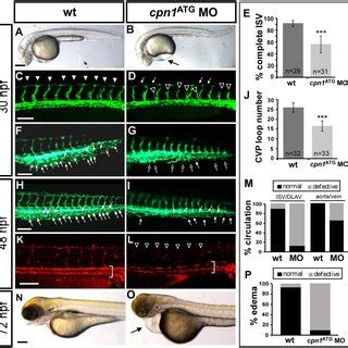 Knockdown Of Cpn Causes Vascular Defects In Zebrafish Development