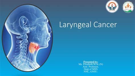 2 Laryngeal Cancer Easy Explanation Ppt