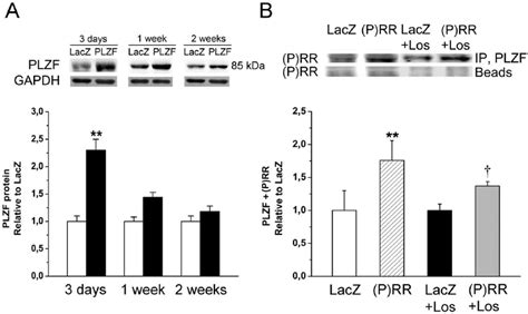 Upregulation Of Promyelocytic Zinc Finger Protein Plzf Prorenin