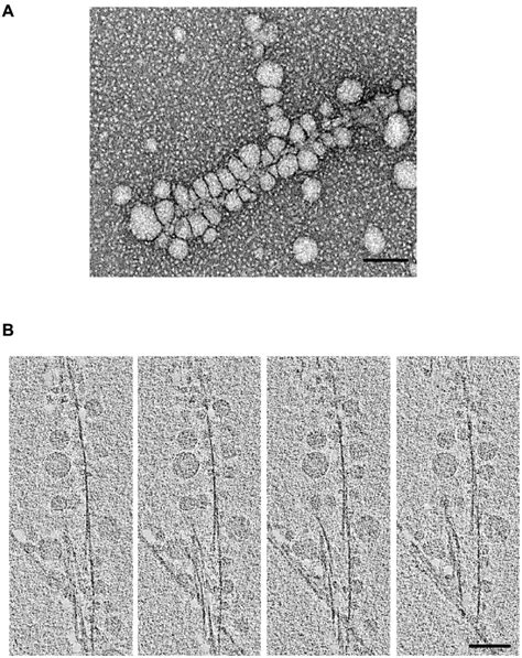 Observations By Cryo Electron Microscopy CEM And Tomography Cryo ET