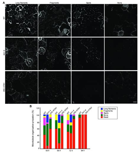 Atktn Regulates Cortical Microtubule Organization In Cotyledon