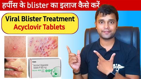 Viral Infection Treatment In Hindi Skin Viral Infection Treatment