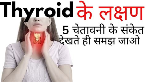 Thyroid Ke Lakshan Kya Hai Thyroid Symptoms In Hindi Youtube